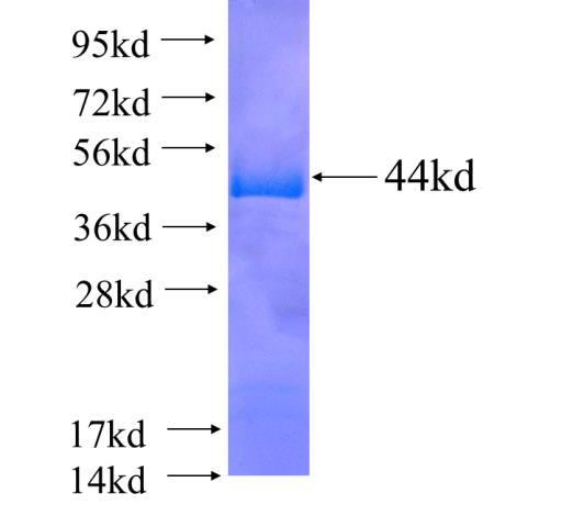 Recombinant human C17orf28 SDS-PAGE