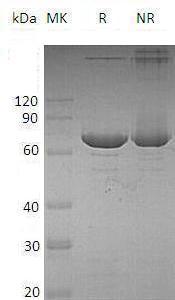 Human ACOX1/ACOX (His tag) recombinant protein