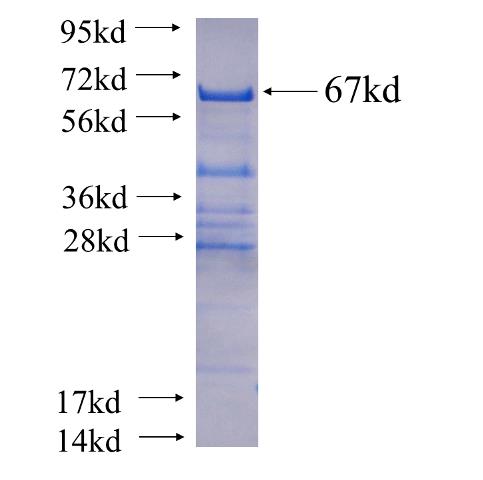 Recombinant human NFE2(Full length) SDS-PAGE