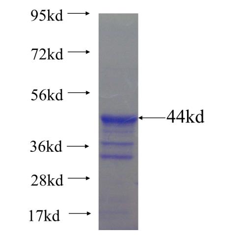 Recombinant human DIAPH3 SDS-PAGE