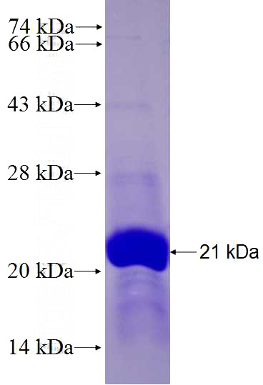 Recombinant Human CPLX1 SDS-PAGE