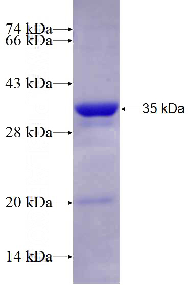Recombinant Human CRK SDS-PAGE