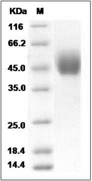 Human MBD2 / DPEP2 Protein (Fc Tag) SDS-PAGE