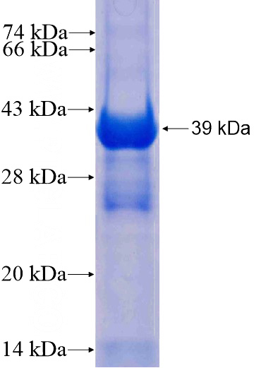 Recombinant Human MPPED2 SDS-PAGE
