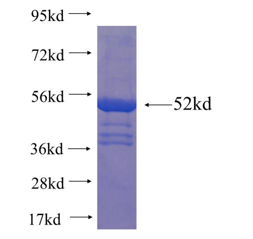 Recombinant human C21orf45 SDS-PAGE