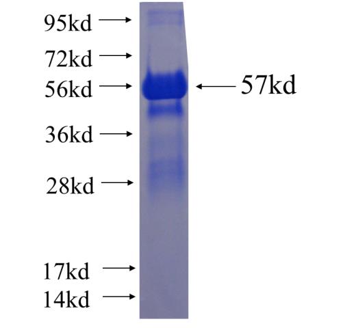 Recombinant human ZYX SDS-PAGE