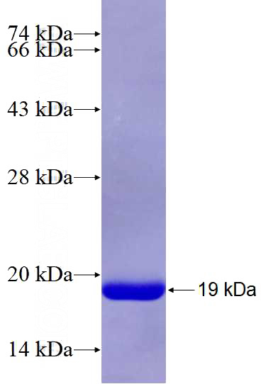 Recombinant Human TMS1 SDS-PAGE