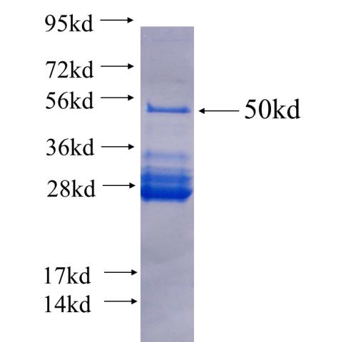Recombinant human ABCF2 SDS-PAGE