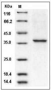 Human COL2A1 Protein (aa 1242-1487, His Tag) SDS-PAGE