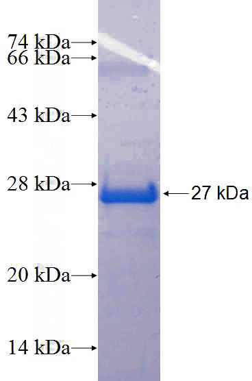 Recombinant Human EPN3 SDS-PAGE