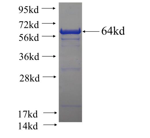 Recombinant human PLD1 SDS-PAGE