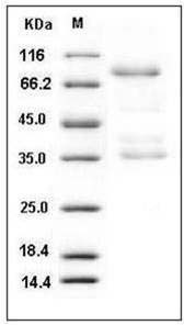 Human AGER / RAGE Protein (Fc Tag) SDS-PAGE