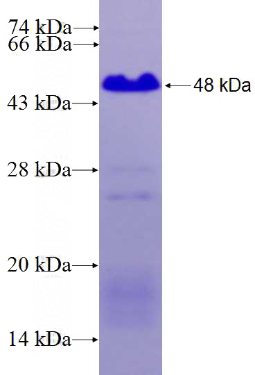 Recombinant Human ERMN SDS-PAGE