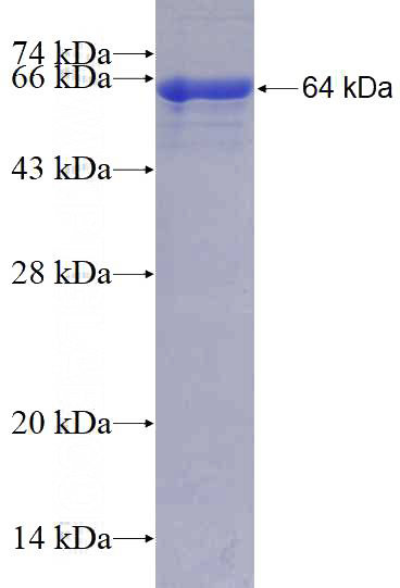 Recombinant Human FKBP10 SDS-PAGE