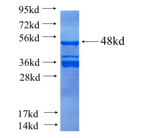 Recombinant human SSX4(Full length) SDS-PAGE