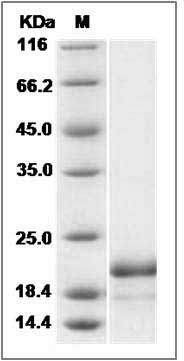 Human ASF1B Protein (His Tag) SDS-PAGE