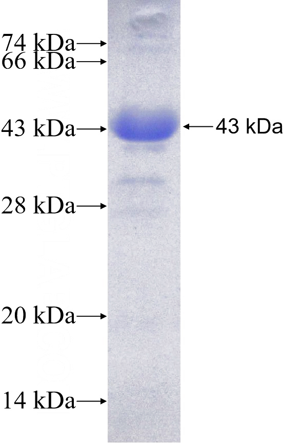 Recombinant Human Ubiquilin 2 SDS-PAGE