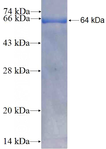 Recombinant Human TERF2IP SDS-PAGE