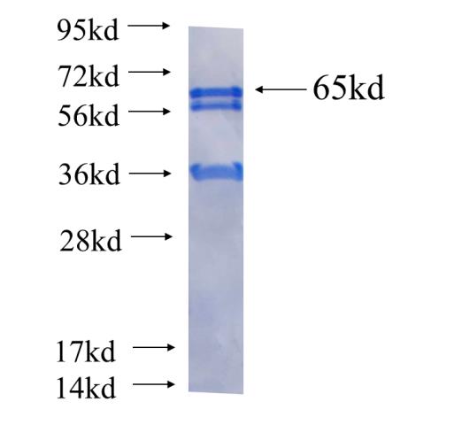 Recombinant human TCEA3(Full length) SDS-PAGE