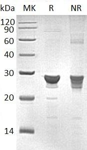 Human GSTZ1/MAAI (His tag) recombinant protein