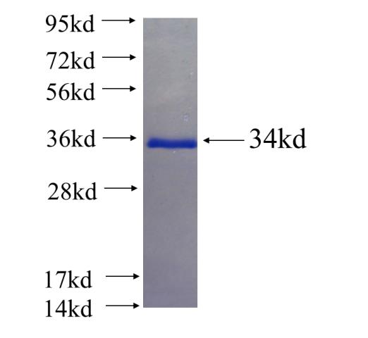 Recombinant human RPS28 SDS-PAGE