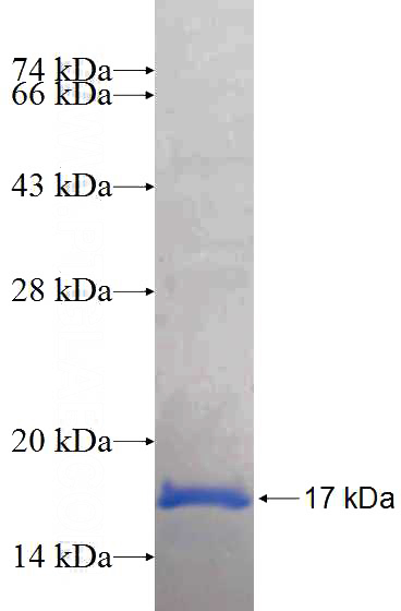 Recombinant Human OXA1L SDS-PAGE