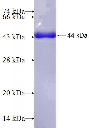 Recombinant Human CEP63 SDS-PAGE