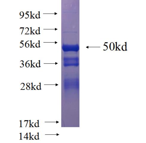 Recombinant human EML4 SDS-PAGE