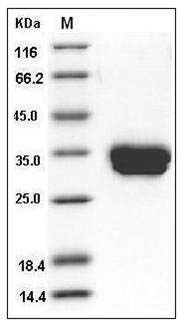 Mouse Carbonic Anhydrase IV / Car4 Protein (His Tag) SDS-PAGE