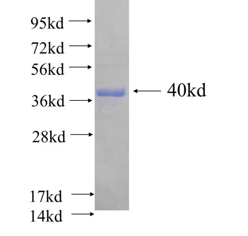 Recombinant human WDR61(Full length) SDS-PAGE