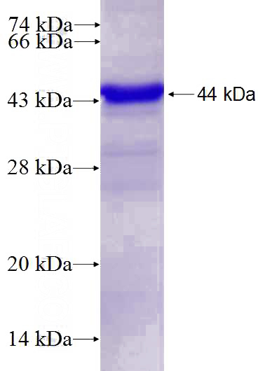 Recombinant Human SYT3 SDS-PAGE