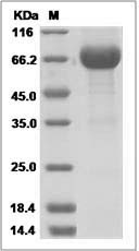 Human IL20RA / IL-20RA Protein (Fc Tag) SDS-PAGE