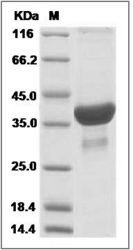 Human ATP6V1F Protein (GST Tag) SDS-PAGE
