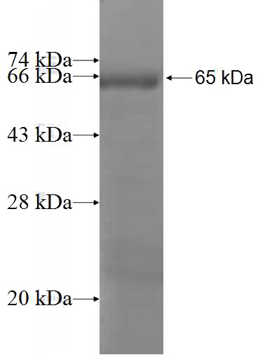 Recombinant Human ABCG4 SDS-PAGE
