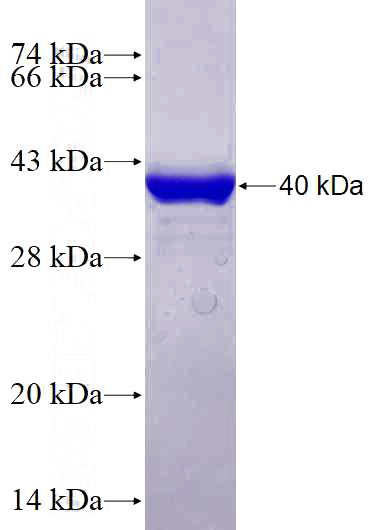 Recombinant Human PDCD5 SDS-PAGE