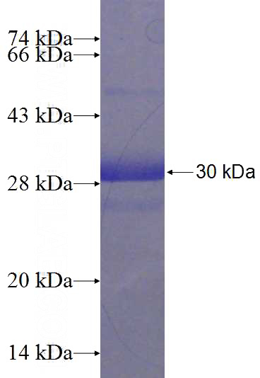 Recombinant Human C19orf20 SDS-PAGE