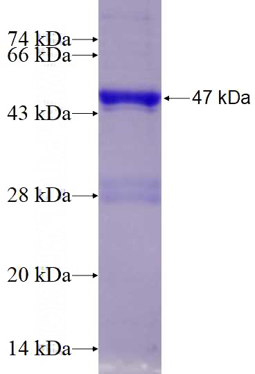 Recombinant Human DCTN6 SDS-PAGE