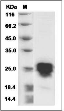 Cynomolgus CD20 / MS4A1 Protein (aa 213-297, His Tag) SDS-PAGE