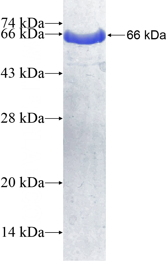Recombinant Human IFIT3 SDS-PAGE