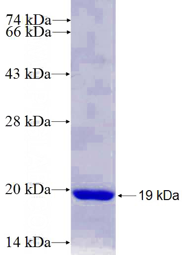 Recombinant Human DNAL1 SDS-PAGE