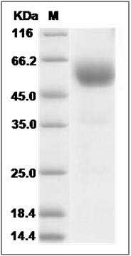 Human SCN2B Protein (Fc Tag) SDS-PAGE