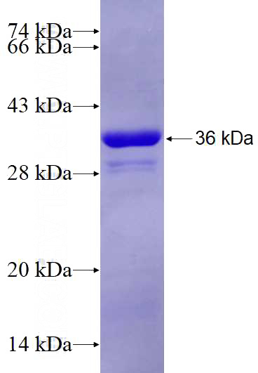 Recombinant Human STOML2 SDS-PAGE