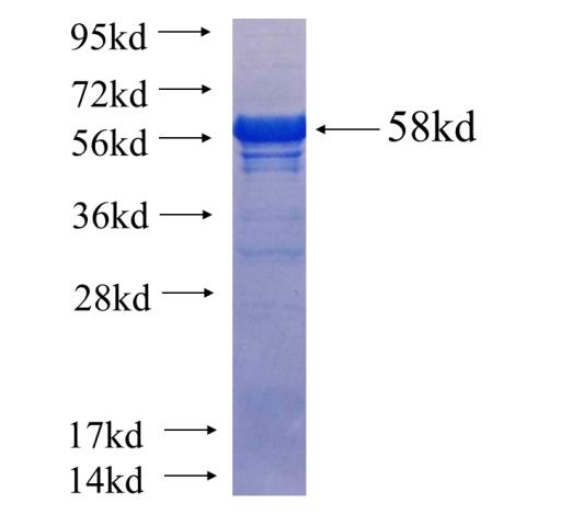 Recombinant human RALYL(Full length) SDS-PAGE