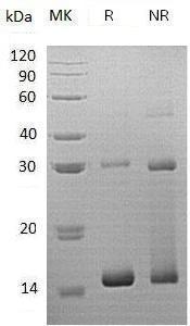 Human HBQ1 (His tag) recombinant protein
