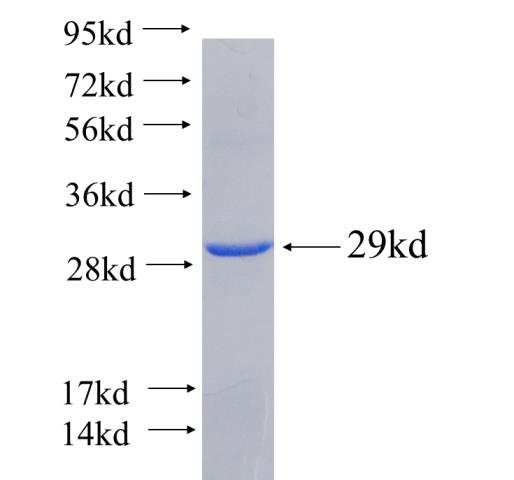 Recombinant human RP11-529I10.4 SDS-PAGE