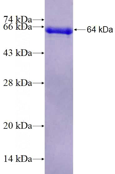 Recombinant Human RNMT SDS-PAGE