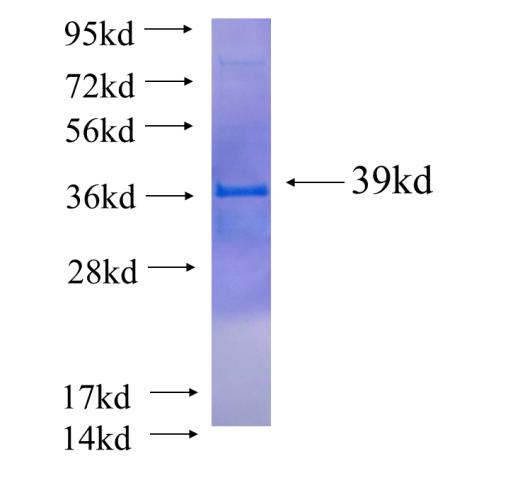 Recombinant human EIF4E3(Full length) SDS-PAGE