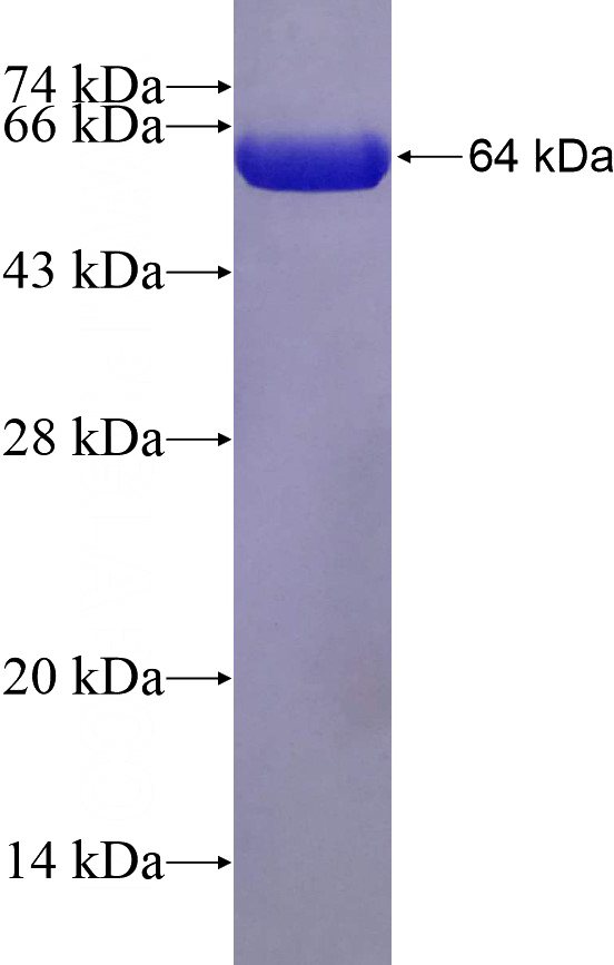 Recombinant Human AAMP SDS-PAGE