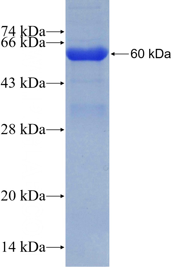 Recombinant Human HYAL2 SDS-PAGE