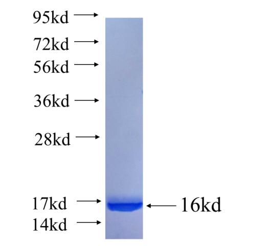 Recombinant human SPRED2 SDS-PAGE
